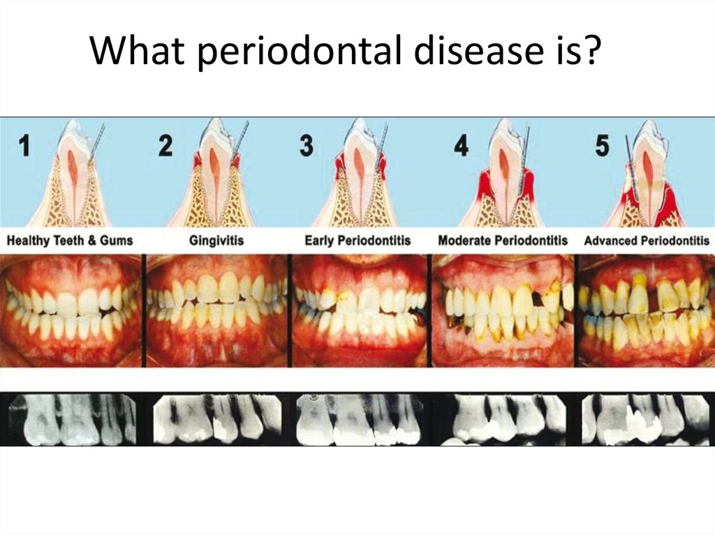 dental-hygienist-for-perio-office