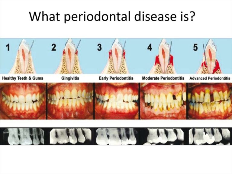 Dental Hygienist for Perio Office